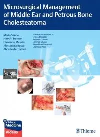 Microsurgical Management of Middle Ear and Petrous Bone Cholesteatoma