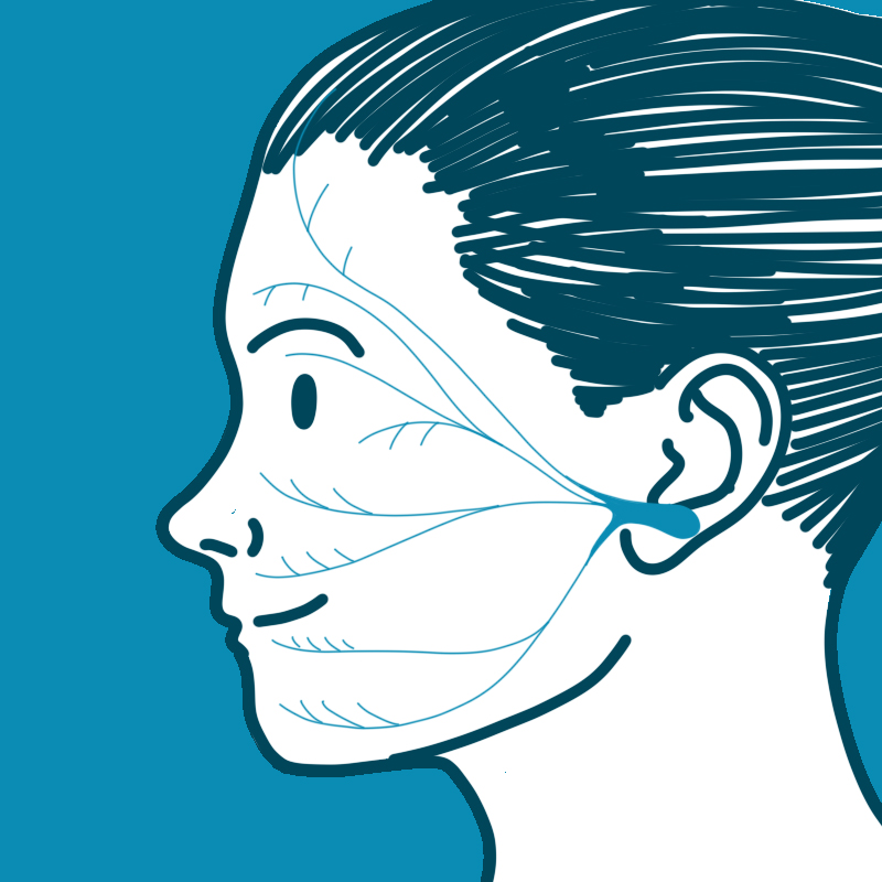Facial Nerve Paralysis - Gruppo Otologico
