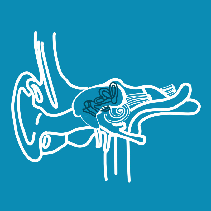 Petrous Bone Cholesteatoma - Gruppo Otologico